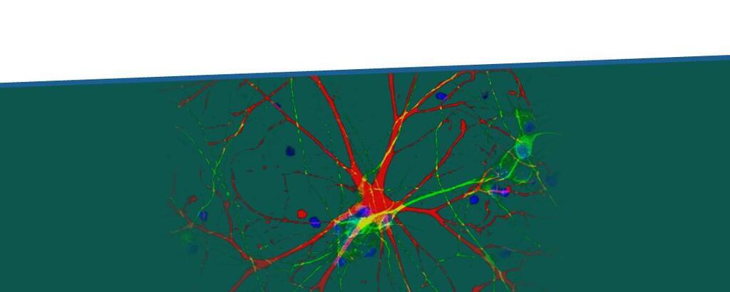 Headerbild Max-Planck-Institut für Psychiatrie